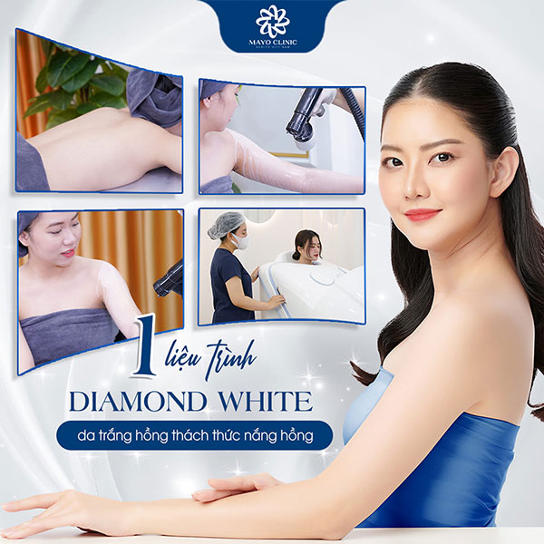 Quy trình thực hiện phun trắng Diamond White tại Mayo Clinic